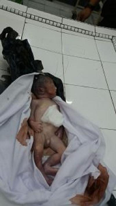 Tegaaa... Ditemukan Warga Dalam Kantong Plastik, Bayi Ini Tak Bernyawa...
