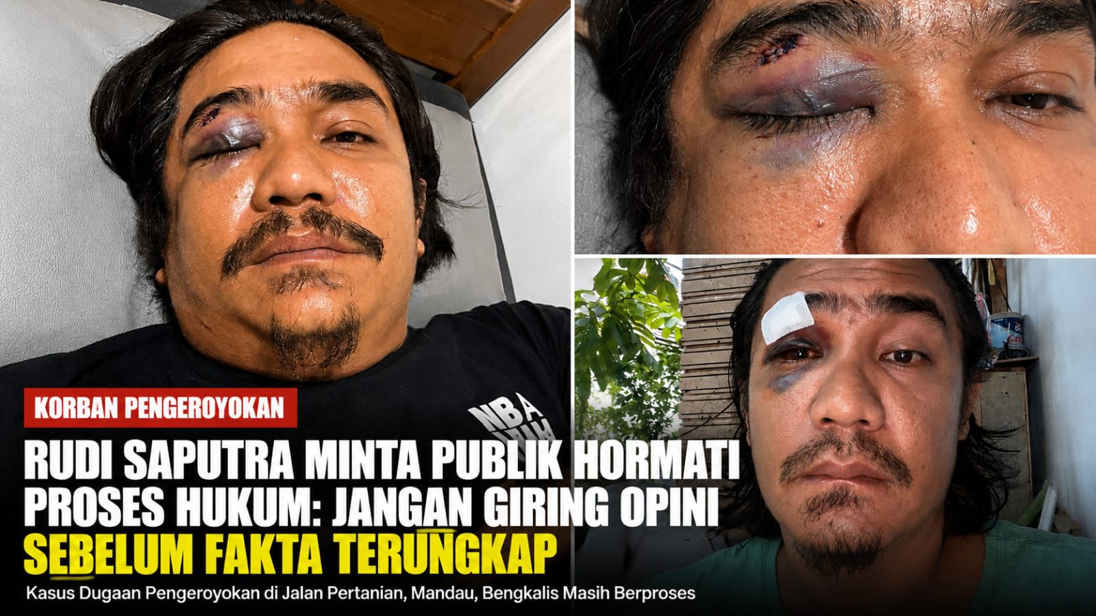 Korban Pengeroyokan Rudi Saputra, Kapolsek Mandau: Penyidik Bekerja Berdasarkan Fakta dan Alat Bukti