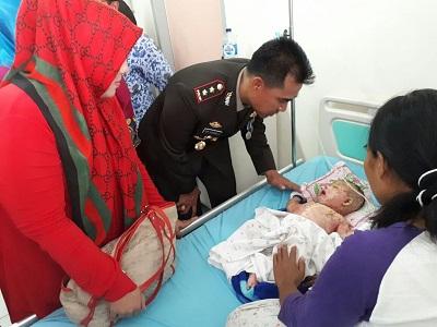 Rayakan HUT RI, Wakapolresta Pekanbaru Kunjungi Anak Penderita Kelainan Kulit