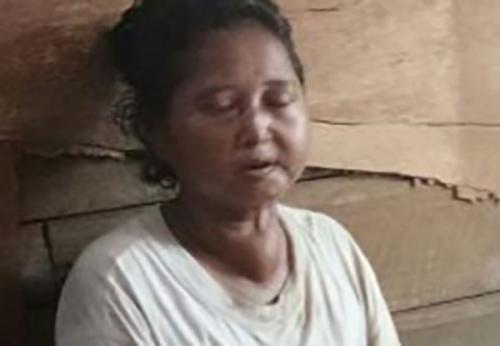 Memprihatinkan, Idap Penyakit di leher Siti Aisyah tidak bisa melakukan aktifitas diluar