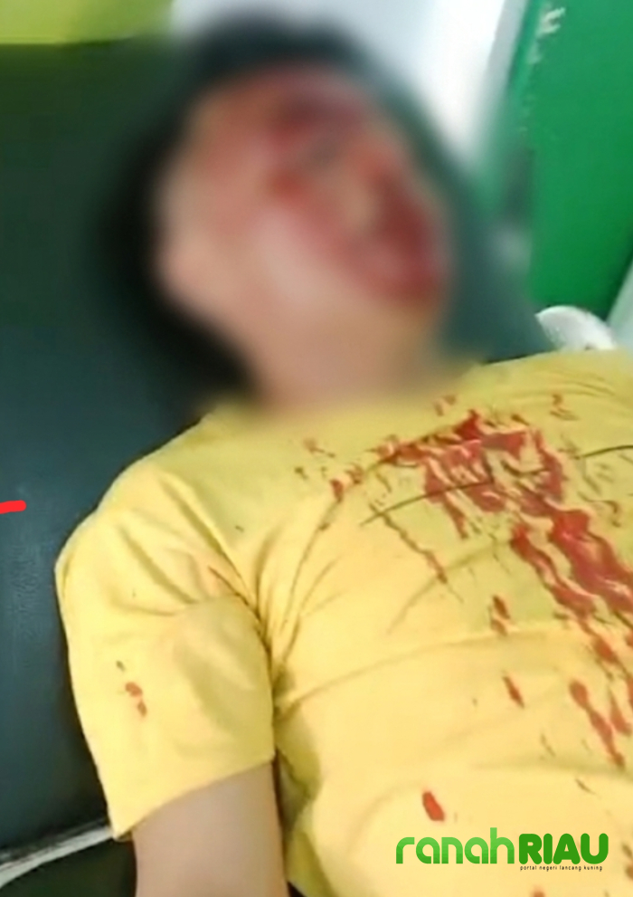 Arsyad kecam serangan terhadap Sekretaris PKC PMIi: Kapolda dan Kapolresta harus segera Bertindak 