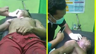 Tersengat alat Penyetrum Ikan, seorang Pemuda tewas mengenaskan...