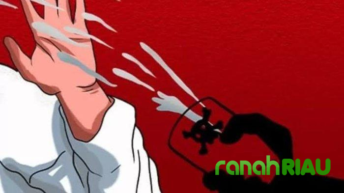 Catatan Redaksi: Ujian Transparansi di Balik Teror Air Keras terhadap Aktivis
