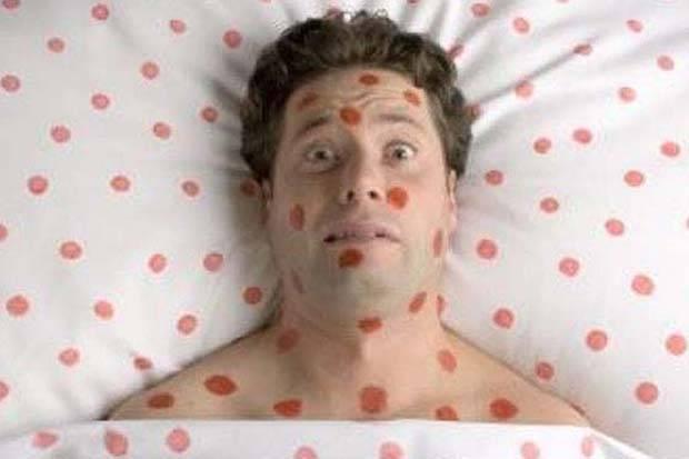 Bisakah Campak Menular pada Mereka yang Telah Divaksin?