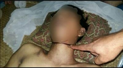 Tolooongg... Wanita Ini Teriak Melihat Pria Gantung Diri di Pohon Mangga, Ternyata?