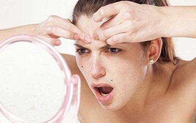 Trik Jitu Basmi Komedo dengan Bahan Alami