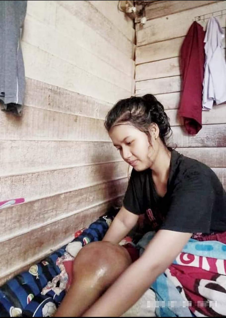 Tak ada biaya, Pemain Voli andalan Sekolah Itu terancam amputasi