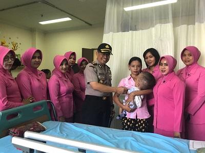 Asyraf Rizqullah Bayi Penderita Hidrosefalus Dapat Bantuan