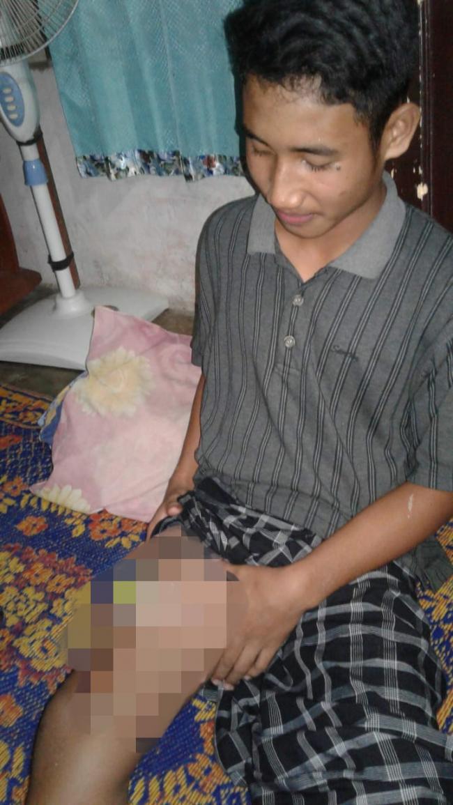 Buaya Serang Warga Kabupaten Kuansing