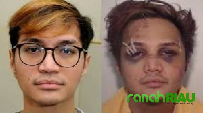 Jadi Samsak, Predator Seksual Reynhard Sinaga babak belur dihajar para tahanan