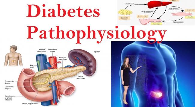 Pria Sulit ubah gaya Hidup perangi Diabetes