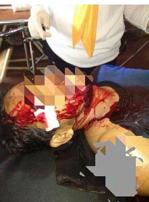 Tak Terima Anaknya Dianiaya, Seorang Pria Dibacok, Pelaku Akhirnya Serahkan Diri...