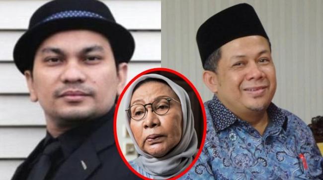 Wajah terlihat Bonyok Pasca Operasi Plastik? Berikut penjelasan Tompi