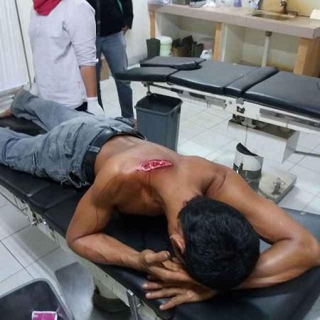 Waduhhh.. Lagi Jaga Kerbau Pria Ini Ditembak OTK, Korban Sempat Melawan...