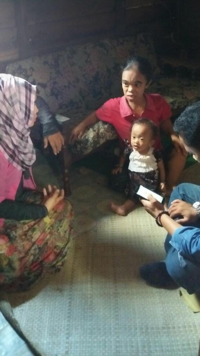 Terkena Gizi Buruk, Balita Ini Langsung Ditangani Dinas kesehatan Inhil