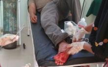 Tak Punya Niat Baik, Pelaku Tabrak Lari Besok Akan Dipolisikan..