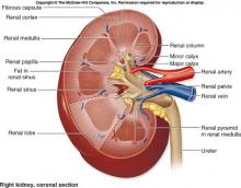 Waspadai Serangan Penyakit Ginjal Kronik