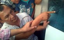 Asap Riau Kembali Tewaskan Bocah 9 Tahun       