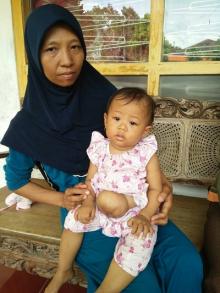 Sedihhh... Menanti Operasi, Usus Bayi 13 Bulan Ini Ada diluar