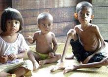 Hal ini juga Menyebabkan Anak Bergizi Buruk