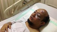 Ini Kronologis Novel Baswedan Disiram Air Keras
